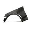 Anderson Composites AC-FF16CHCAM-SS AND Fenders